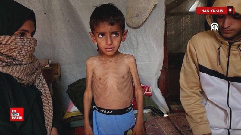 Gazze’de insani felaket derinleşiyor, küçük Osama yaşam mücadelesi veriyor