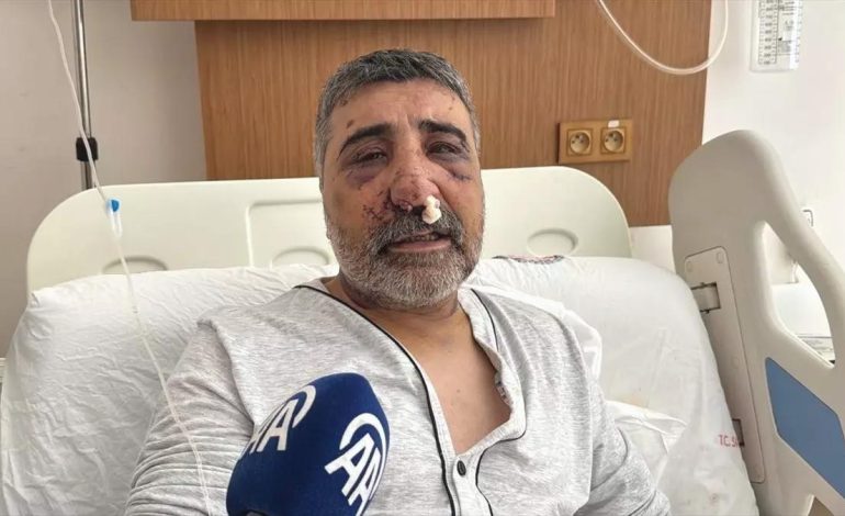 İngiliz Boksör Taksi Şoförünü Darbetti