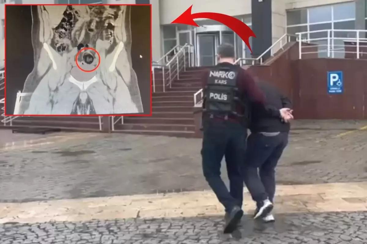 İranlı yolcunun makatından uyuşturucu çıktı