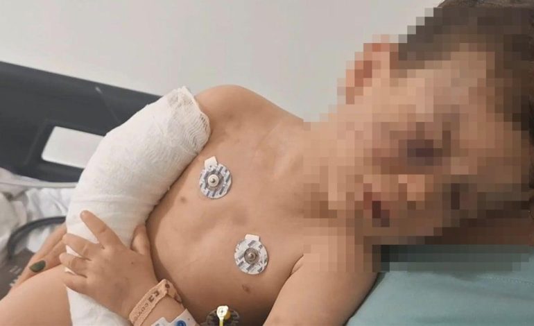 2 yaşındaki çocuğa vahşeti yaşattılar! Anne ve sevgilisi gözaltında