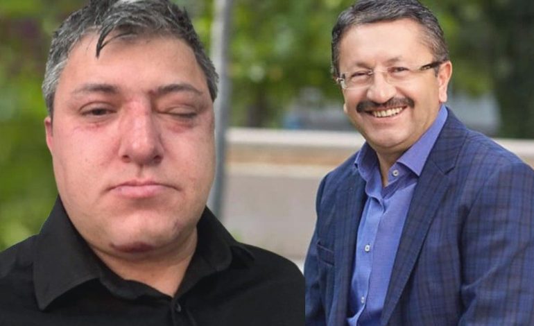 Akılalmaz iddia… Buraya kadar geldik mi? Belediye başkanı ve yardımcıları işçi dövdü