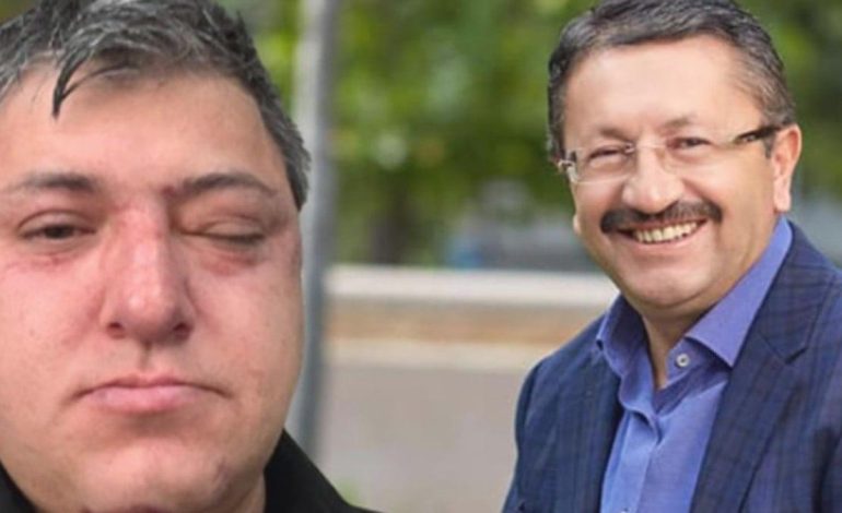 Altındağ Belediyesi personelinin darbedilmesine ilişkin soruşturmada zabıta müdürü tutuklandı!