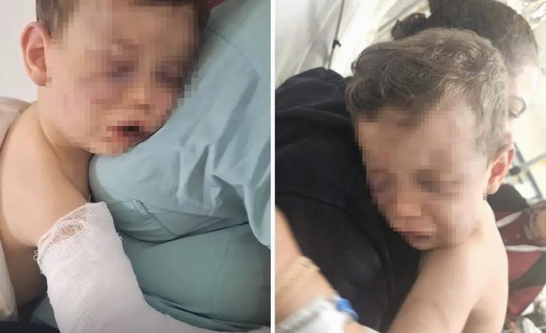 Annesinin sevgilisinin öldüresiye darbettiği Aren bebeği yakmaya çalışmışlar