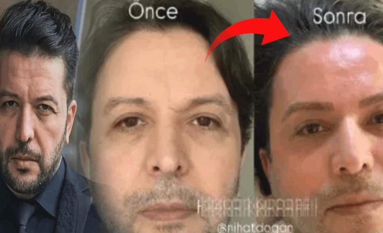 Bu gerçekten Nihat Doğan mı?