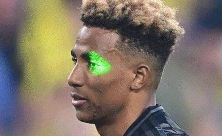 Derbinin ardından lazer gözaltısı