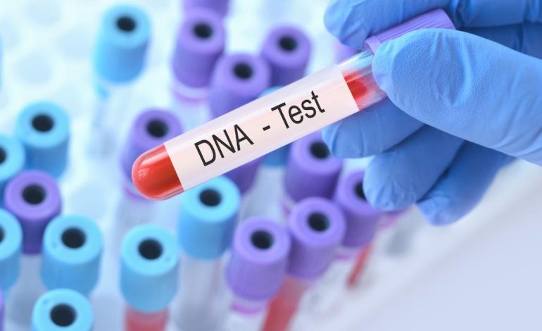 -Eğlencesine DNA testi yaptıran kadın kocasıyla kardeş çıktı