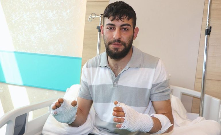 Erzurum’da hararet yapan otomobiline aceleyle müdahale edince hastanelik oldu