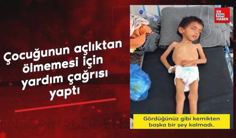 Gazze’de çocuğunun açlıktan ölmemesi için yardım çağrısı yaptı