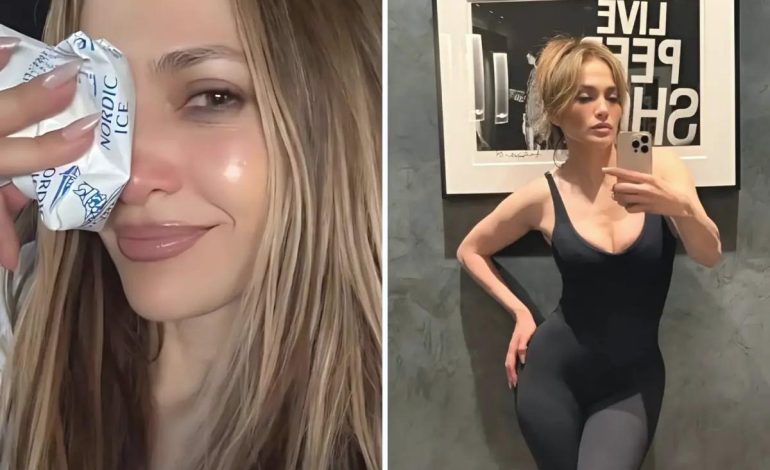Jennifer Lopez, Amerikan Müzik Ödülleri provaları sırasında yüzünden yaralandı